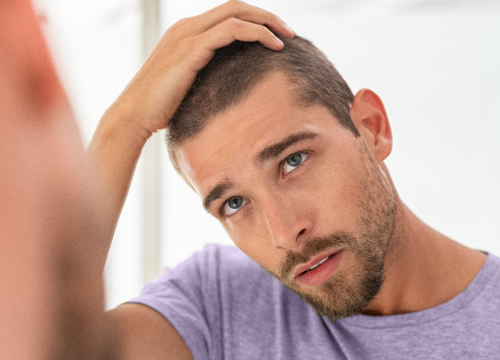 Man touching his head after PRP for hair loss