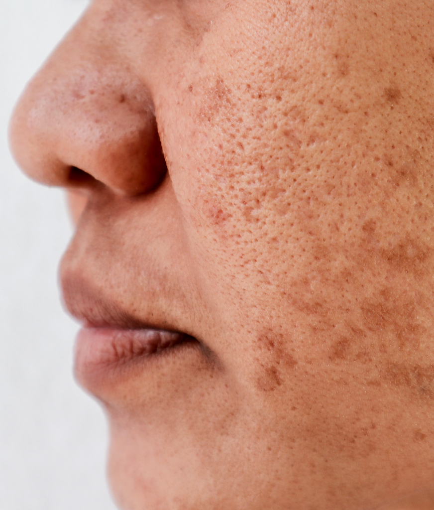 Close up on a woman's face in profile